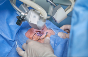 lasik procedure is painless